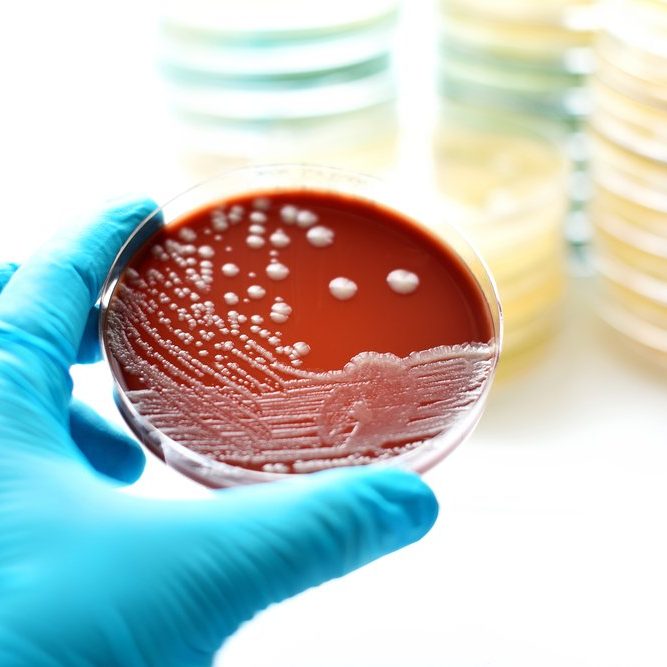 Pipework chlorination & disinfection to BS8558